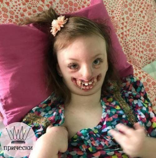 Бедная девочка, которая прожила короткую жизнь болела синдромом Ретта - наследственное и очень редкое заболевание. 02