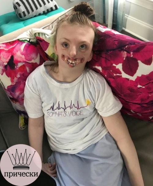 Бедная девочка, которая прожила короткую жизнь болела синдромом Ретта - наследственное и очень редкое заболевание. 01