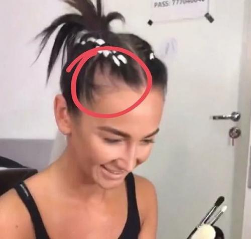 Сожженная шевелюра и выпадающие волосы: волосяные проблемы звезд. 03