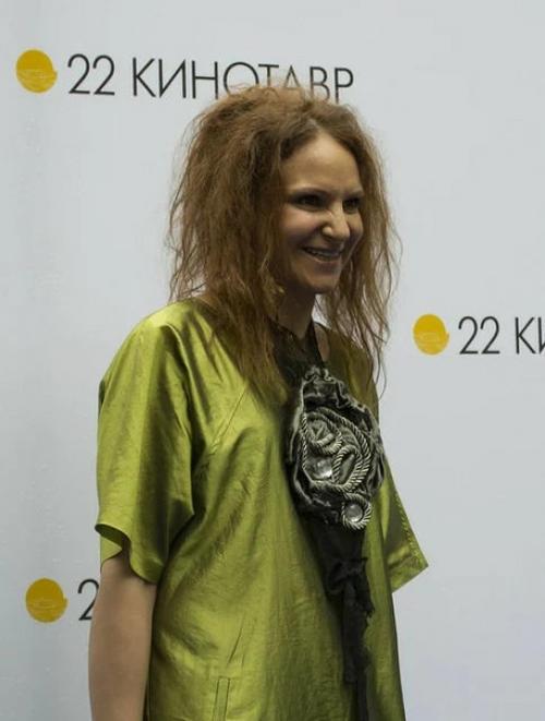 Сожженная шевелюра и выпадающие волосы: волосяные проблемы звезд. 04