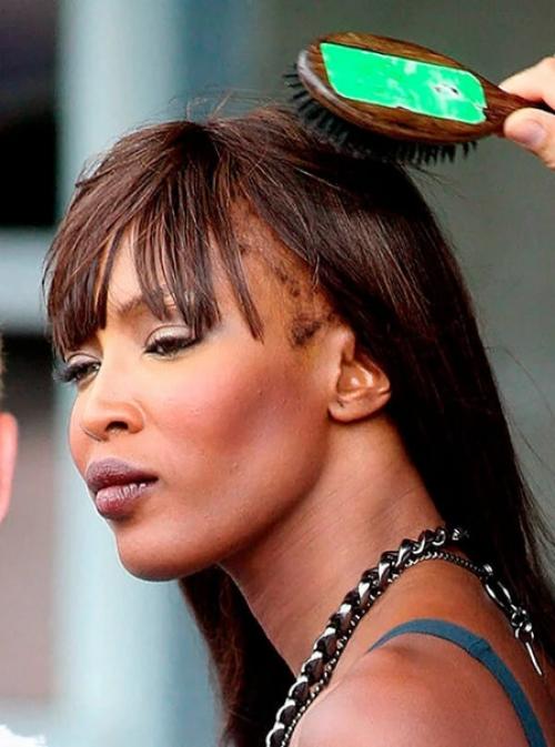 Сожженная шевелюра и выпадающие волосы: волосяные проблемы звезд. 05