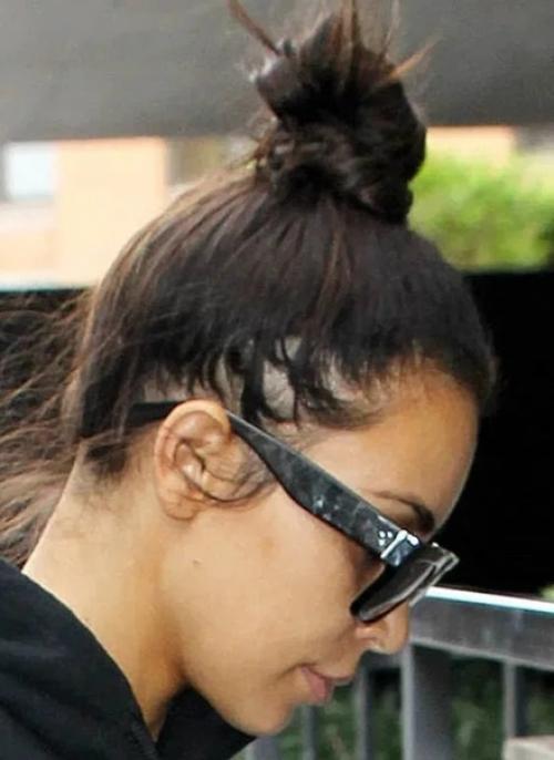 Сожженная шевелюра и выпадающие волосы: волосяные проблемы звезд. 01