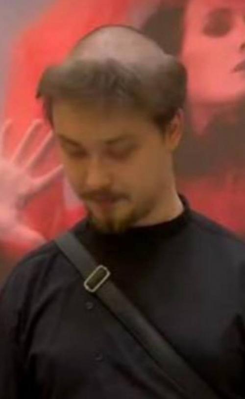 Болезнь, пересадка волос или стрижка под католического монаха? 01 Болезнь, пересадка волос или стрижка под католического монаха? 01