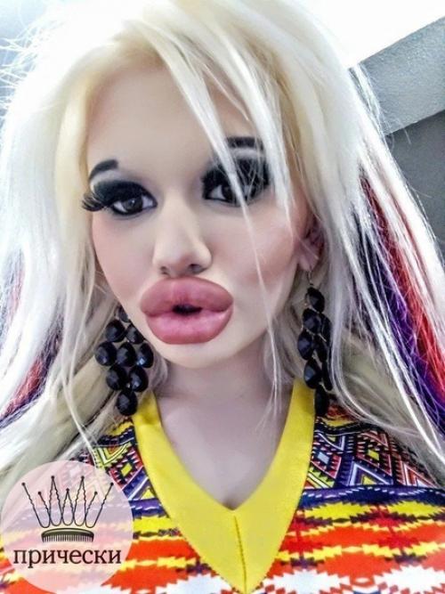 Сколько же тут сделано пластических операций? 01