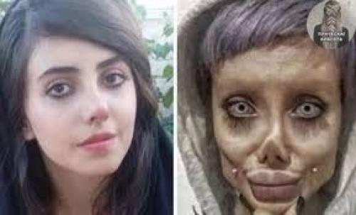 Женщина сделала 50 операций, чтобы быть похожей на Анджелину Джоли. 04