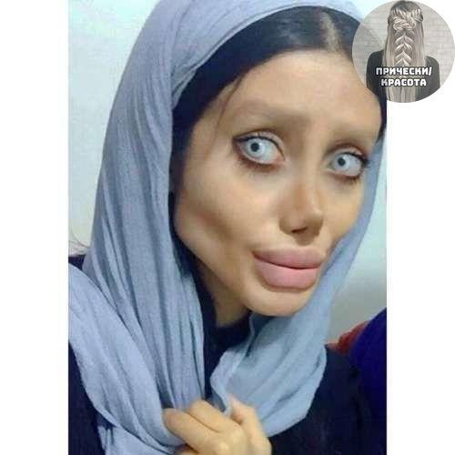 Женщина сделала 50 операций, чтобы быть похожей на Анджелину Джоли. 03