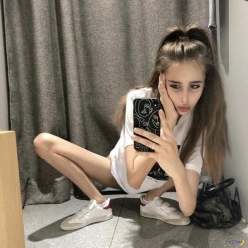 Она думала, если похудеет на 30 кг, то будет очень красивая. 02