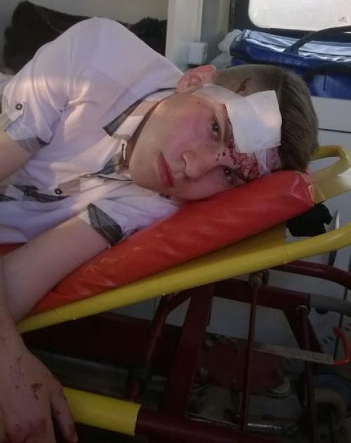 Минск: пешеход уверяет, что велосипедист ударил его битой за ходьбу по велодорожке. 02