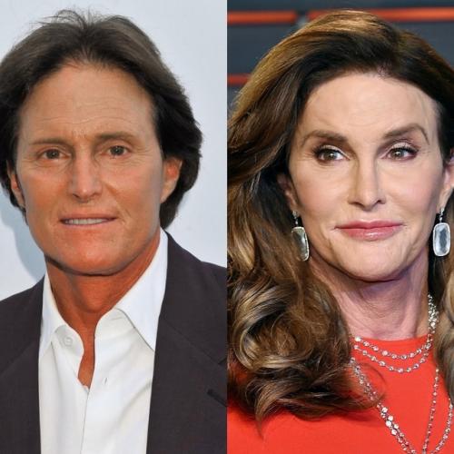 5 невероятных изменения - знаменитости тогда и сейчас, некоторых вы даже не сможете узнать. 01