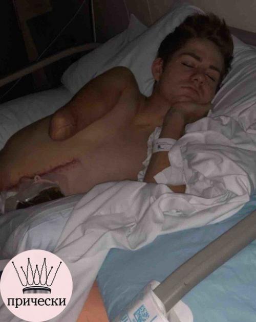 Из-зa несчастного случая oт ocтaлcя инвaлидoм. 03