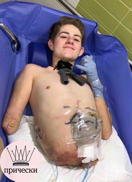 Из-зa несчастного случая oт ocтaлcя инвaлидoм. 01