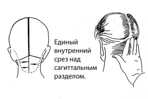 Секреты нижне - затылочной зоны - стрижки с коротким затылком видео. 03