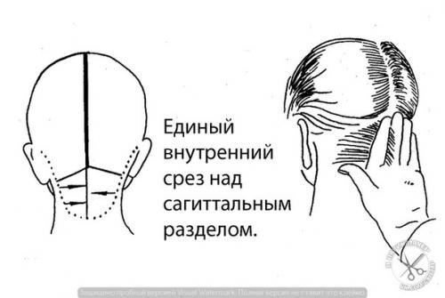 Зона нижнего затылка - достаточно сложный отдел головы в плане моделирования стрижки. 02