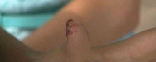 Раненная молнией женщина ребенка с необычными патологиями родила. 01