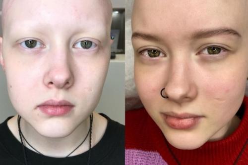 10 лет назад сибирячка Наталья еселевич делала макияж и прически красоткам, а теперь рисует соски и брови женщинам с раком груди. 02