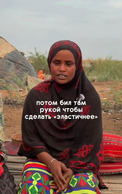 В Эфиопии муж посадил жену на раскалённые угли, пытаясь расширить её вагину. 01
