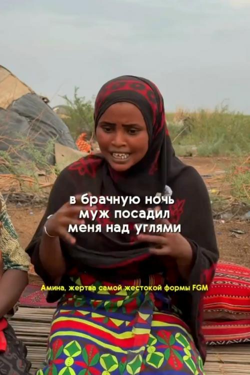 В Эфиопии муж посадил жену на раскалённые угли, пытаясь расширить её вагину.

