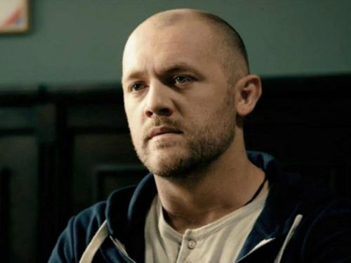 Заголовок: звезда Мажора Денис шведов избавился от залысин пересадкой волос. 01