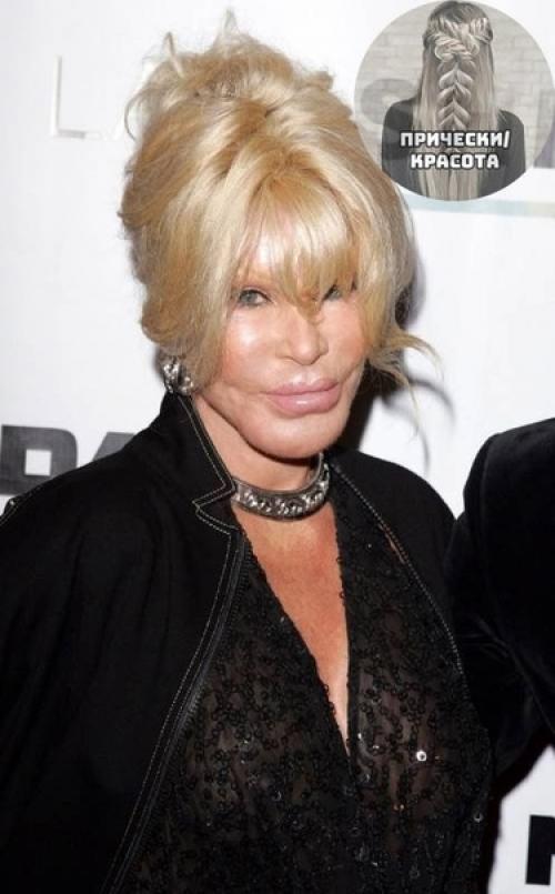 Сколько же тут сделано пластических операций? 05