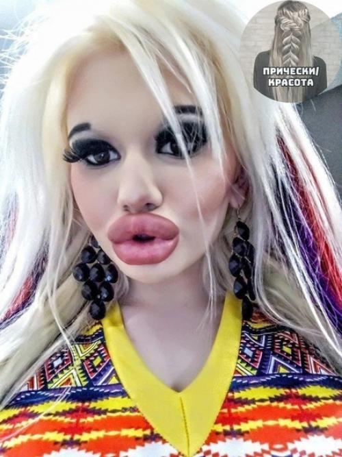 Сколько же тут сделано пластических операций? 01