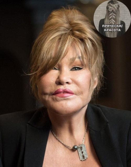 Сколько же тут сделано пластических операций? 02