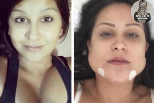 Как менялись люди с пластическими операциями. 02