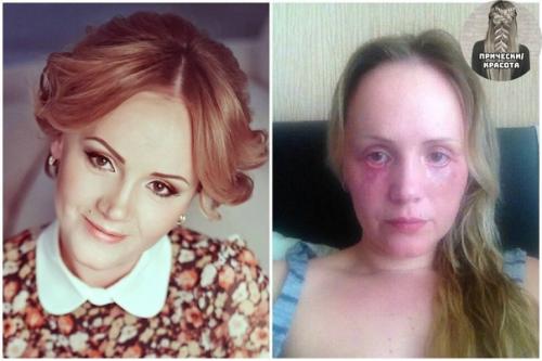 Как менялись люди с пластическими операциями. 03