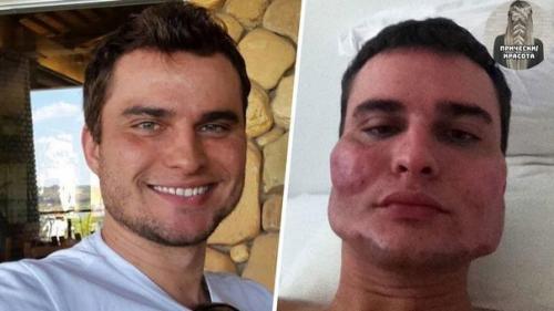 Как менялись люди с пластическими операциями. 01