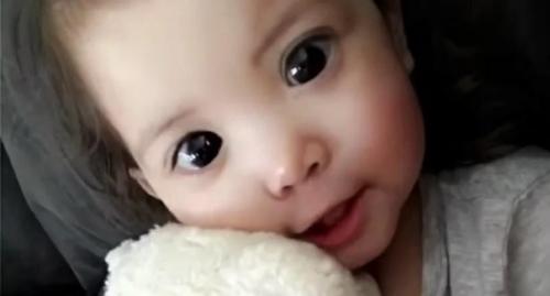 Из-за генетического сбоя девочка с чрезвычайно большими глазами родилась. 04