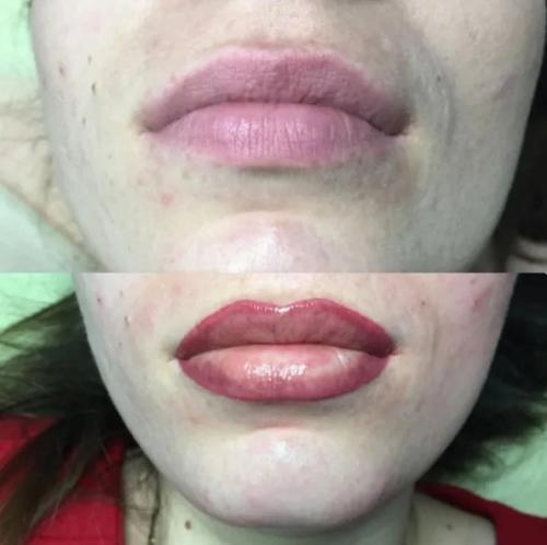 Неудачный татуаж губ: жуткие примеров с фотографиями после процедуры. 05