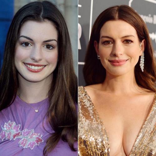 Наи Дите 10 отличии! 02