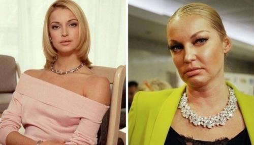 Анастасия волочкова раньше и сейчас. 02