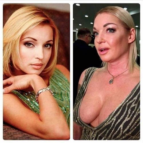 Анастасия волочкова раньше и сейчас. 01