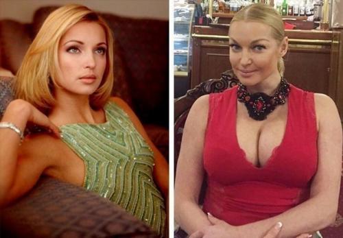 Анастасия волочкова раньше и сейчас. 03