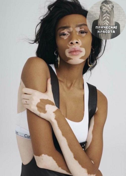 Красивая, не смотря ни на что. 01