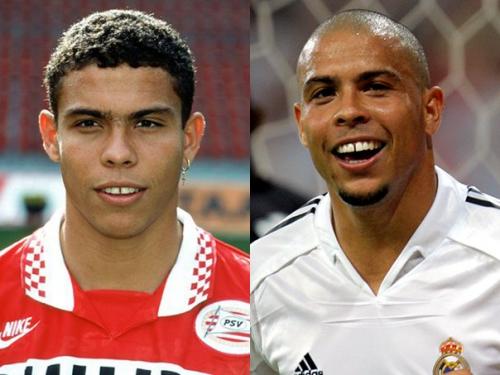 15 знаменитых лысых футболистов, у которых когда-то были волосы? 04 15 знаменитых лысых футболистов, у которых когда-то были волосы? 04