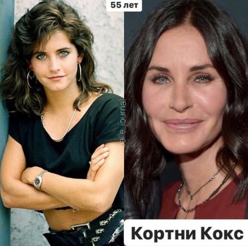 Перечеркнуть, а не подчеркнуть жертвы пластических операций. 04