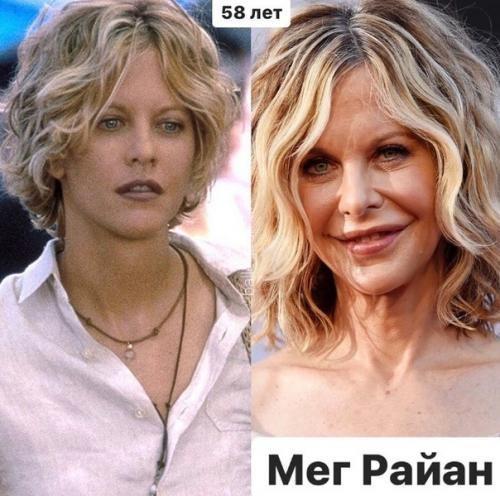 Перечеркнуть, а не подчеркнуть жертвы пластических операций. 05