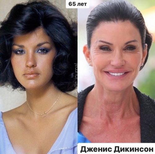 Перечеркнуть, а не подчеркнуть жертвы пластических операций. 02