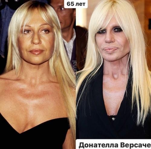 Перечеркнуть, а не подчеркнуть жертвы пластических операций. 06