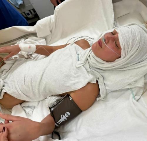 В сети подозревают, что Белла хадид страдает не от болезни лайма, а от последствий анорексии. 01