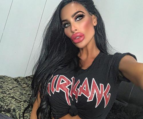 Тара Джейн восхищалась внешностью Анджелины Джоли и решила сделать себе пластику. 02