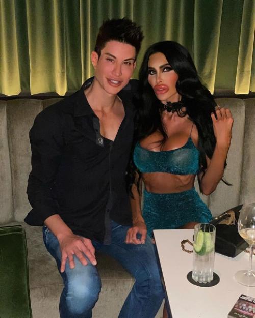 Тара Джейн восхищалась внешностью Анджелины Джоли и решила сделать себе пластику. 01