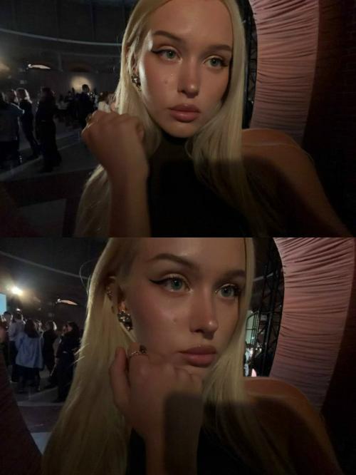 Лиза лпшка не принимает себя даже после ринопластики и плачет из-за Кривого носа. 02