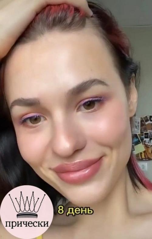 Вот все так против увеличения губ, а как по мне выглядит очень красиво и естественно. 06