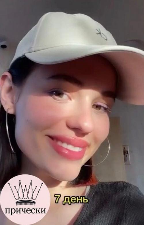 Вот все так против увеличения губ, а как по мне выглядит очень красиво и естественно. 05