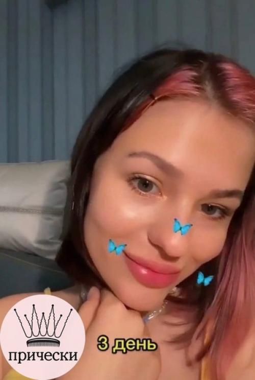 Вот все так против увеличения губ, а как по мне выглядит очень красиво и естественно. 04