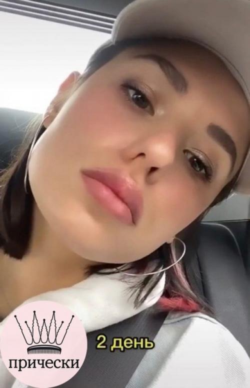 Вот все так против увеличения губ, а как по мне выглядит очень красиво и естественно. 03