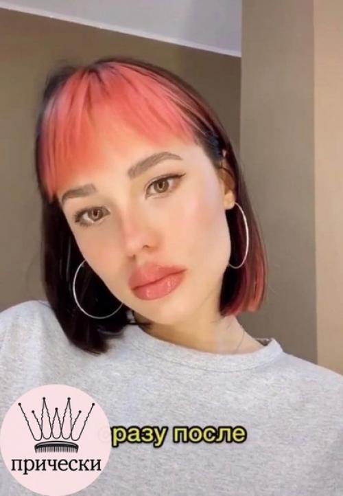 Вот все так против увеличения губ, а как по мне выглядит очень красиво и естественно. 02