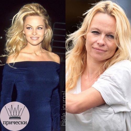 Даже люди с деньгами не всегда стареют красиво. 04